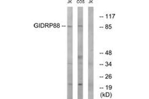 Western blot analysis of extracts from Jurkat/COS cells, using GIDRP88 Antibody. (GIDRP88 anticorps  (AA 721-770))