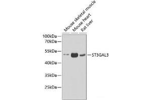 Western blot analysis of extracts of various cell lines using ST3GAL3 Polyclonal Antibody at dilution of 1:1000. (ST3GAL3 anticorps)