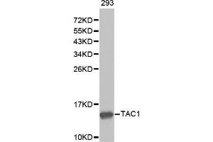 Western blot analysis of extracts of 293 cell lines, using TAC1 antibody. (TAC1 anticorps  (AA 1-129))