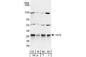 Western Blotting (WB) image for anti-YY1 Associated Factor 2 (YAF2) (AA 50-100) antibody (ABIN7452993)
