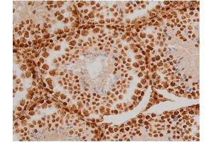ABIN6267384 at 1/200 staining Mouse testis tissue sections by IHC-P. (Ezrin anticorps  (pTyr353))
