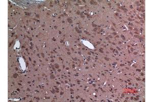 Immunohistochemistry (IHC) analysis of paraffin-embedded Rat Brain, antibody was diluted at 1:100. (UBE2A/B (C-Term) anticorps)