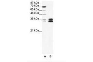Image no. 1 for anti-Nuclear Factor-kB p65 (NFkBP65) (AA 21-70) antibody (ABIN203274) (NF-kB p65 anticorps  (AA 21-70))