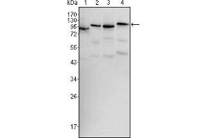 Western blot analysis using BRAF mouse mAb against Hela (1), HL60 (2), HepG2 (3) and NIH/3T3 (4) cell lysate. (BRAF anticorps)