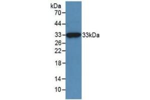 WB of Protein Standard: different control antibodies against Highly purified E. (MGEA5 Kit ELISA)