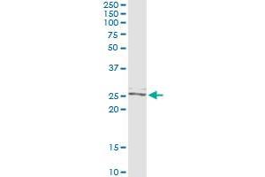 Immunoprecipitation of TWIST2 transfected lysate using anti-TWIST2 monoclonal antibody and Protein A Magnetic Bead , and immunoblotted with TWIST2 MaxPab rabbit polyclonal antibody.