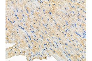 ABIN6260772 and ABIN6266926 at 1/100 staining Mouse heart tissue by IHC-P. (CERKL anticorps  (Internal Region))