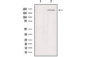 Western blot analysis of extracts from Mouse lung, using Na+ CP type IXalpha Antibody. (SCN9A anticorps  (Internal Region))