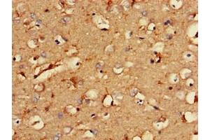 Immunohistochemistry of paraffin-embedded human brain tissue using ABIN7146282 at dilution of 1:100 (RCAN2 anticorps  (AA 88-197))