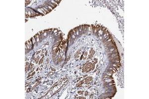 Immunohistochemical staining of human bronchus with C11orf60 polyclonal antibody  shows moderate cytoplasmic and membrane positivity in respiratory epithelial cells at 1:500-1:1000 dilution. (IFT46 anticorps)