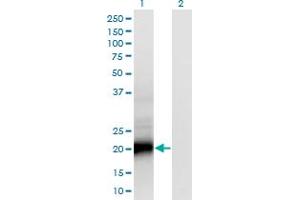 Western Blot analysis of SMUG1 expression in transfected 293T cell line by SMUG1 monoclonal antibody (M07), clone 4D5.