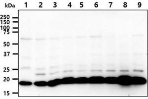The cell lysates (40ug) were resolved by SDS-PAGE, transferred to PVDF membrane and probed with anti-human SSU72 antibody (1:1000). (SSU72 anticorps)