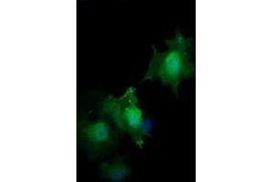 Image no. 4 for anti-HRas proto-oncogene, GTPase (HRAS) antibody (ABIN1498716) (HRAS anticorps)
