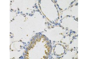 Immunohistochemistry of paraffin-embedded Rat lung using PON2 Polyclonal Antibody at dilution of 1:100 (40x lens). (PON2 anticorps)