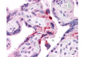 Immunohistochemistry (IHC) image for anti-Leucine Rich Repeat Containing 8 Family, Member B (LRRC8B) (Middle Region) antibody (ABIN2773892)