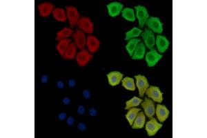 ABIN6260161 and ABIN6279063 staining Hela cells by IF/ICC. (AWAT2 anticorps  (Internal Region))