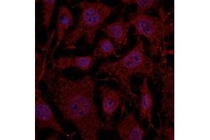 Immunofluorescence (IF) image for anti-RAB11B, Member RAS Oncogene Family (RAB11B) (C-Term) antibody (ABIN1440027) (RAB11B anticorps  (C-Term))