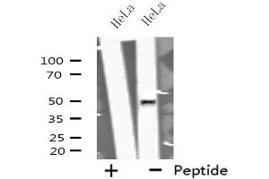 Western blot analysis of extracts from HeLa cells using GORASP2 antibody. (GORASP2 anticorps  (Internal Region))