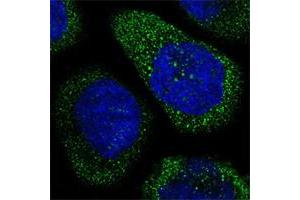 Immunofluorescent staining of human cell line A-431 shows positivity in cytoplasm. (THSD1 anticorps)