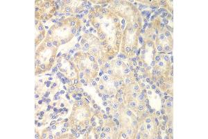 Immunohistochemistry (IHC) image for anti-Deleted in Liver Cancer 1 (DLC1) (AA 204-463) antibody (ABIN3015711) (DLC1 anticorps  (AA 204-463))