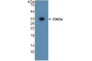 Detection of Recombinant GPC3, Mouse using Polyclonal Antibody to Glypican 3 (GPC3) (Glypican 3 anticorps  (AA 344-559))