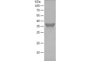Western Blotting (WB) image for Eukaryotic Translation Elongation Factor 1 alpha 2 (EEF1A2) (AA 373-463) protein (His-IF2DI Tag) (ABIN7122827)