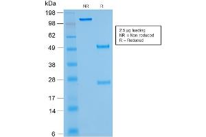 SDS-PAGE Analysis of Purified IGKC Mouse Recombinant Monoclonal Antibody ABIN6383813.