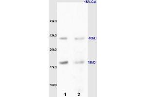 L1 rat kidney lysates L2 rat liver lysates probed with Anti RCL/c Myc responsive Polyclonal Antibody, Unconjugated (ABIN872485) at 1:200 overnight at 4 °C. (RCL anticorps  (AA 101-174))