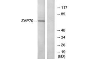 Western blot analysis of extracts from Jurkat cells, using ZAP-70 (Ab-319) Antibody. (ZAP70 anticorps  (AA 286-335))