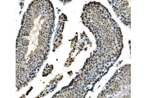 IHC analysis of LSM8 using anti-LSM8 antibody (ABIN7599579). (NAA38 anticorps  (AA 1-96))
