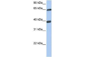 WB Suggested Anti-TKT  Antibody Titration: 0. (TKT anticorps  (N-Term))