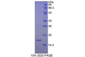 SDS-PAGE (SDS) image for Renalase, FAD-Dependent Amine Oxidase (RNLS) (AA 18-150) protein (His tag) (ABIN1981112) (RNLS Protein (AA 18-150) (His tag))