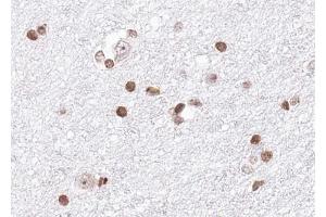 ABIN6268816 at 1/100 staining human brain tissue sections by IHC-P. (HNRNPA1 anticorps  (Internal Region))