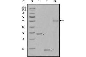 Western blot analysis using Ki67 mouse mAb against truncated Trx-Ki67 recombinant protein(1),truncated Ki67 (aa3118-3256)-His recombinant protein(2) and truncated Ki67 (aa3118-3256)-hIgGFc transfected CHO-K1 cell lysate(3). (Ki-67 anticorps  (AA 3118-3256))