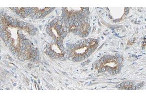 ABIN6276506 at 1/100 staining Human prostate tissue by IHC-P. (Thymidine Phosphorylase anticorps  (N-Term))