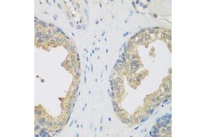 Immunohistochemistry of paraffin-embedded human prostate using ENPEP antibody  at dilution of 1:200 (40x lens).