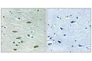 Immunohistochemistry analysis of paraffin-embedded human brain tissue using IGF1R (Ab-1346) antibody.