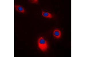Immunofluorescent analysis of c-SRC staining in K562 cells. (Src anticorps  (C-Term))