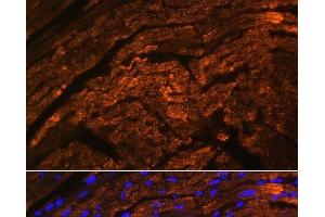 Immunofluorescence analysis of Rat heart using TTN Polyclonal Antibody at dilution of 1:100. (Titin anticorps)