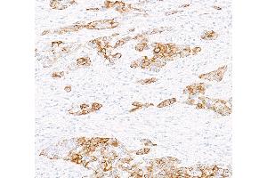 Immunohistochemistry (IHC) image for anti-Keratin 6 (KRT6) (C-Term) antibody (ABIN7795793)