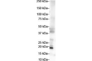 WB Suggested Anti-FGF2 Antibody Titration:  2 ug/ml  ELISA Titer:  1:312500  Positive Control:  Hela cell lysate (FGF2 anticorps  (Middle Region))