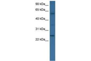Image no. 1 for anti-Bone Morphogenetic Protein 6 (BMP6) (AA 46-95) antibody (ABIN6746538) (BMP6 anticorps  (AA 46-95))