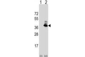 Western Blotting (WB) image for anti-Aspartoacylase (ASPA) antibody (ABIN3002840) (ASPA anticorps)