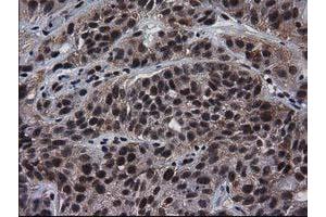 Image no. 1 for anti-Nonhomologous End-Joining Factor 1 (NHEJ1) antibody (ABIN1499728)