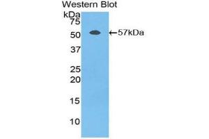 Western blot analysis of the recombinant protein. (Fibrinogen beta Chain anticorps  (AA 49-495))