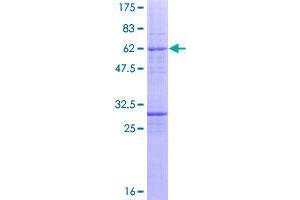 Image no. 1 for Ets Homologous Factor (EHF) (AA 1-300) protein (GST tag) (ABIN1352469)