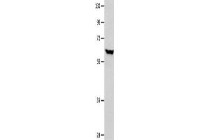 Western Blotting (WB) image for anti-DnaJ (Hsp40) Homolog, Subfamily C, Member 7 (DNAJC7) antibody (ABIN2421969) (DNAJC7 anticorps)
