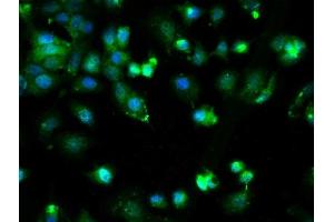 Image provided by One World Lab validation program. (CYBB anticorps  (AA 501-570))