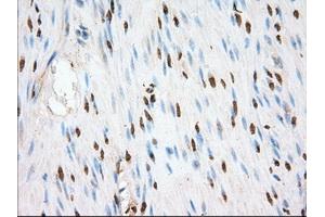 Image no. 10 for anti-Transforming, Acidic Coiled-Coil Containing Protein 3 (TACC3) antibody (ABIN1498099) (TACC3 anticorps)