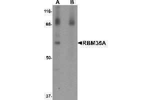 Western Blotting (WB) image for anti-Epithelial Splicing Regulatory Protein 1 (ESRP1) (N-Term) antibody (ABIN1031534) (ESRP1 anticorps  (N-Term))